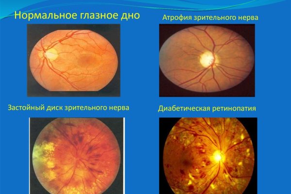 Кракен современный маркет